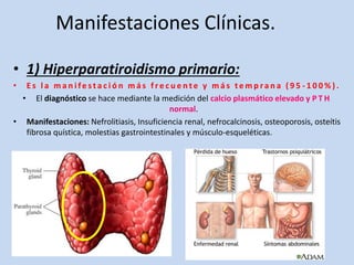 Manifestaciones Clínicas.
• 1) Hiperparatiroidismo primario:
• E s l a m a n i fe s t a c i ó n m á s f r e c u e n t e y m á s t e m p ra n a ( 9 5 - 1 0 0 % ) .
• El diagnóstico se hace mediante la medición del calcio plasmático elevado y P T H
normal.
• Manifestaciones: Nefrolitiasis, Insuficiencia renal, nefrocalcinosis, osteoporosis, osteítis
fibrosa quística, molestias gastrointestinales y músculo-esqueléticas.
 