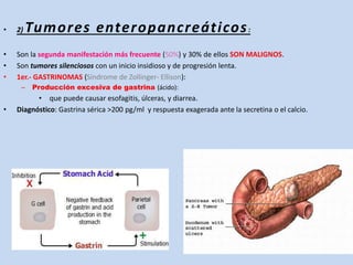 • 2) Tumores enteropancreáticos:
• Son la segunda manifestación más frecuente (50%) y 30% de ellos SON MALIGNOS.
• Son tumores silenciosos con un inicio insidioso y de progresión lenta.
• 1er.- GASTRINOMAS (Síndrome de Zollinger- Ellison):
– Producción excesiva de gastrina (ácido):
• que puede causar esofagitis, úlceras, y diarrea.
• Diagnóstico: Gastrina sérica >200 pg/ml y respuesta exagerada ante la secretina o el calcio.
 