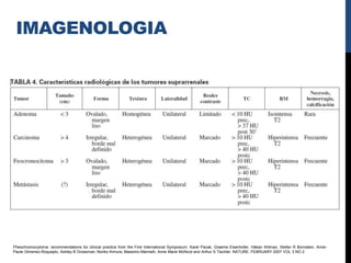 IMAGENOLOGIA




Pheochromocytoma: recommendations for clinical practice from the First International Symposium. Karel Pacak, Graeme Eisenhofer, Håkan Ahlman, Stefan R Bornstein, Anne-
Paule Gimenez-Roqueplo, Ashley B Grossman, Noriko Kimura, Massimo Mannelli, Anne Marie McNicol and Arthur S Tischler. NATURE. FEBRUARY 2007 VOL 3 NO 2
 