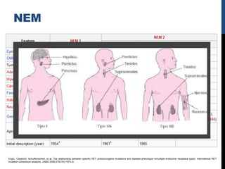 NEM




EngC, ClaytonD, SchuffeneckerI, et al. The relationship between specific RET protooncogene mutations and disease phenotype inmultiple endocrine neoplasia type2. International RET
mutation consortium analysis. JAMA 2006;276(19):1575–9.
 