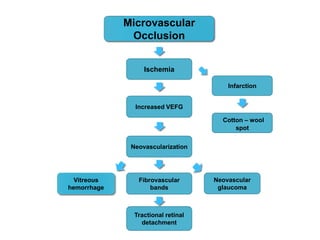 Cotton – wool
spot
Neovascularization
Ischemia
Neovascular
glaucoma
Microvascular
Occlusion
Fibrovascular
bands
Vitreous
hemorrhage
Increased VEFG
Tractional retinal
detachment
Infarction
 