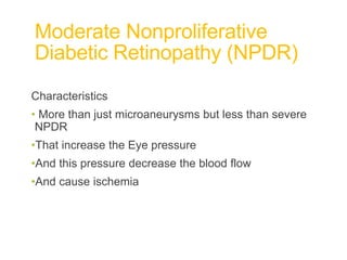 Moderate Nonproliferative
Diabetic Retinopathy (NPDR)
Characteristics
• More than just microaneurysms but less than severe
NPDR
•That increase the Eye pressure
•And this pressure decrease the blood flow
•And cause ischemia
 