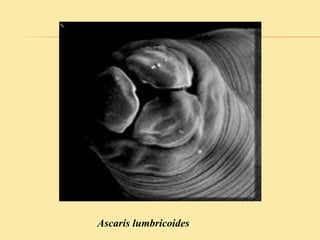 Ascaris lumbricoides
 