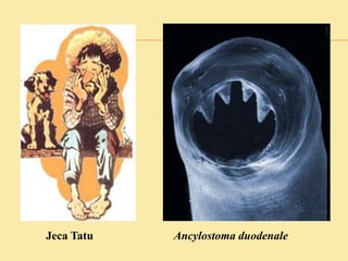 Ancylostoma duodenaleJeca Tatu
 