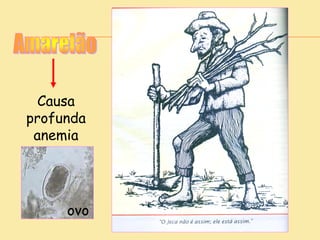 Causa
profunda
anemia
ovo
 