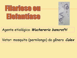 Agente etiológico: Wuchereria bancrofti
Vetor: mosquito (pernilongo) do gênero Culex
 