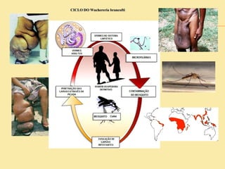 CICLO DO Wuchereria brancofti
 