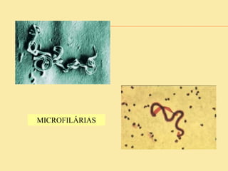 MICROFILÁRIAS
 