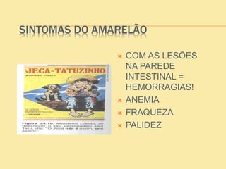 SINTOMAS DO AMARELÃO
 COM AS LESÕES
NA PAREDE
INTESTINAL =
HEMORRAGIAS!
 ANEMIA
 FRAQUEZA
 PALIDEZ
 