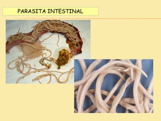 PARASITA INTESTINAL
 