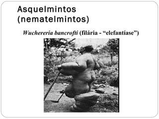 Asquelmintos (nematelmintos) Wuchereria bancrofti  (filária - “elefantíase”) 