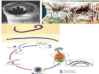 Asquelmintos (nematelmintos) 