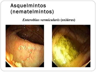 Asquelmintos (nematelmintos) Enterobius vermicularis  (oxiúrus) 