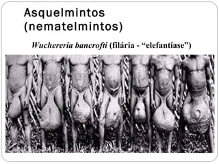 Asquelmintos (nematelmintos) Wuchereria bancrofti  (filária - “elefantíase”) 