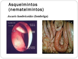 Asquelmintos (nematelmintos) Ascaris lumbricoides  (lombriga) 