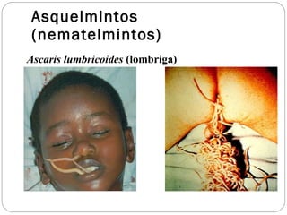 Asquelmintos (nematelmintos) Ascaris lumbricoides  (lombriga) 