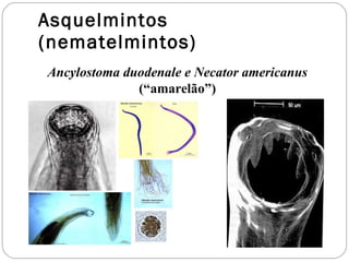 Asquelmintos (nematelmintos) Ancylostoma duodenale e Necator americanus  (“amarelão”) 
