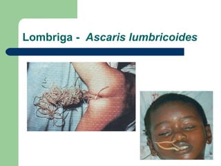 Lombriga -  Ascaris lumbricoides 