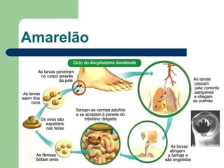 Amarelão 