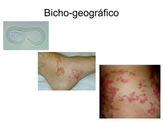 Bicho-geográfico
 