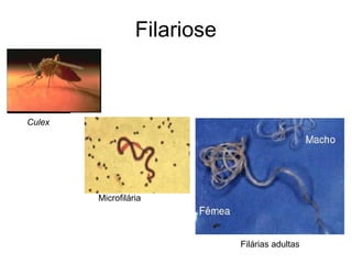 Filariose



Culex




        Microfilária




                              Filárias adultas
 