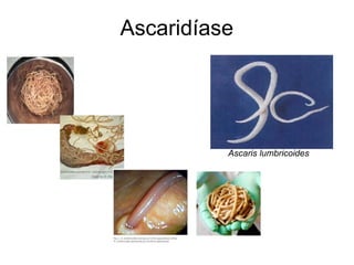 Ascaridíase




          Ascaris lumbricoides
 
