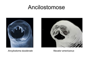 Ancilostomose




Ancylostoma duodenale   Necator americanus
 