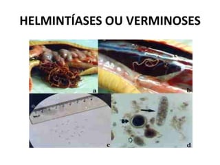 HELMINTÍASES OU VERMINOSES
 