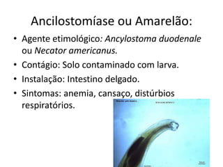 Ancilostomíase ou Amarelão:
• Agente etimológico: Ancylostoma duodenale
  ou Necator americanus.
• Contágio: Solo contaminado com larva.
• Instalação: Intestino delgado.
• Sintomas: anemia, cansaço, distúrbios
  respiratórios.
 