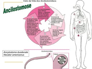 Ancilostomose Ancylostoma duodenale Necator americanus 