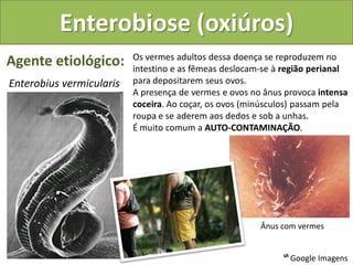 Enterobiose (oxiúros)
                          Os vermes adultos dessa doença se reproduzem no
Agente etiológico:        intestino e as fêmeas deslocam-se à região perianal
Enterobius vermicularis   para depositarem seus ovos.
                          A presença de vermes e ovos no ânus provoca intensa
                          coceira. Ao coçar, os ovos (minúsculos) passam pela
                          roupa e se aderem aos dedos e sob a unhas.
                          É muito comum a AUTO-CONTAMINAÇÃO.




                                                        Ânus com vermes


                                                             ᔥ Google Imagens
 
