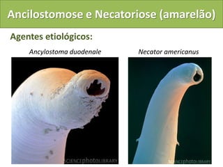 Ancilostomose e Necatoriose (amarelão)
Agentes etiológicos:
    Ancylostoma duodenale   Necator americanus
 