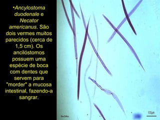•Ancylostoma
duodenale e
Necator
americanus. São
dois vermes muitos
parecidos (cerca de
1,5 cm). Os
ancilóstomos
possuem uma
espécie de boca
com dentes que
servem para
"morder" a mucosa
intestinal, fazendo-a
sangrar.
 