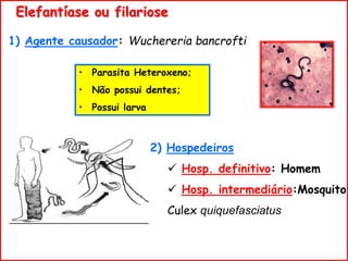 1) Agente causador: Wuchereria bancrofti
2) Hospedeiros
 Hosp. definitivo: Homem
 Hosp. intermediário:Mosquito
Culex quiquefasciatus
Elefantíase ou filariose
• Parasita Heteroxeno;
• Não possui dentes;
• Possui larva
 
