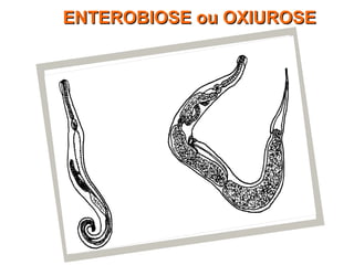 ENTEROBIOSE ou OXIUROSEENTEROBIOSE ou OXIUROSE
 