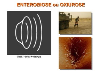 ENTEROBIOSE ou OXIUROSEENTEROBIOSE ou OXIUROSE
Vídeo. Fonte: WhatsApp
 