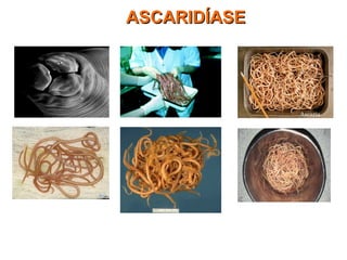 ASCARIDÍASEASCARIDÍASE
 