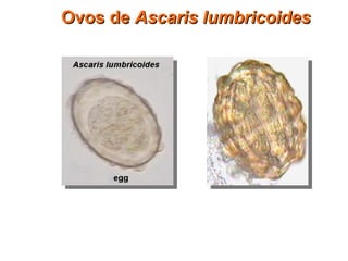 Ovos deOvos de Ascaris lumbricoidesAscaris lumbricoides
 