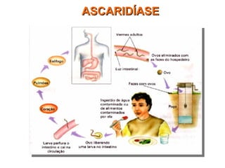 ASCARIDÍASEASCARIDÍASE
 