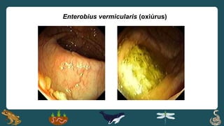Enterobius vermicularis (oxiúrus)
 