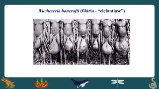 Wuchereria bancrofti (filária - “elefantíase”)
 