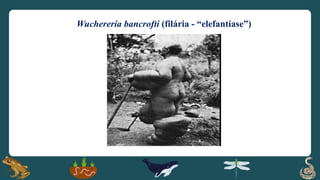 Wuchereria bancrofti (filária - “elefantíase”)
 
