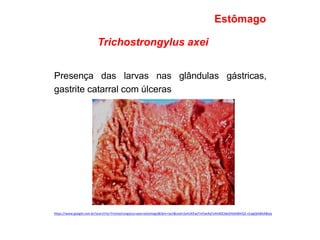 Trichostrongylus axei
Presença das larvas nas glândulas gástricas,
gastrite catarral com úlceras
Estômago
https://www.google.com.br/search?q=Trichostrongylus+axei+estomago&tbm=isch&ved=2ahUKEwjTmYjw4qToAhX0CbkGHbIABAIQ2-cCegQIABAA&oq
 