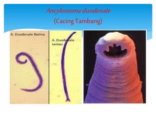 Ancylostomaduodenale
(Cacing Tambang)
 