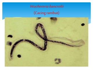Wuchereriabancrofti
(Cacing rambut)
 
