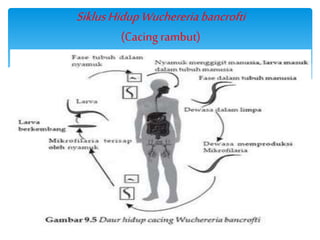 SiklusHidupWuchereriabancrofti
(Cacing rambut)
 