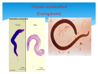 Oxyurisvermicullaris
(Cacing kremi)
 