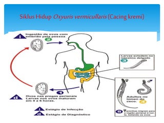 SiklusHidupOxyurisvermicullaris(Cacing kremi)
 