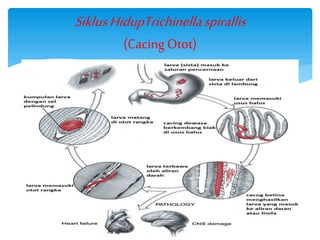 SiklusHidupTrichinellaspirallis
(Cacing Otot)
 