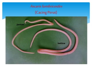 Ascarislumbricoides
(Cacing Perut)
 